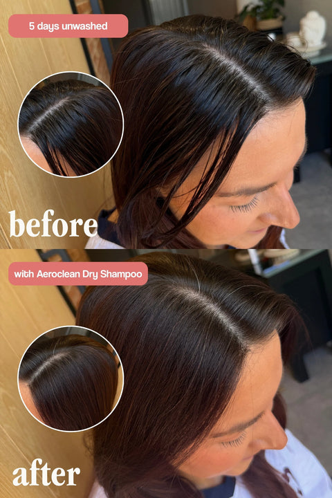 Vani-T Aeroclean Dry Shampoo